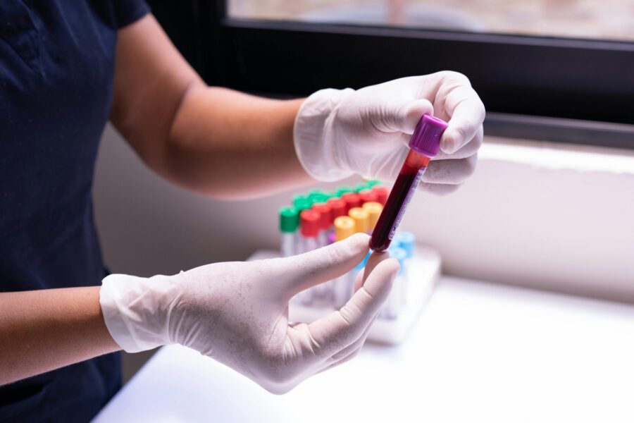 This picture shows a clinican holding a blood sample bottle.